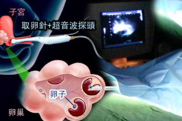 广州代孕哪家更靠谱,广州幸孕星供卵生殖中心,广州合法供卵试管中心