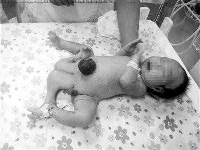 如何给宝宝穴位按摩 一些常见病该怎么治疗