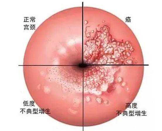 广州医院供精供卵流程 广州试管婴儿什么情况下不能移植鲜胚? ‘孕后期b超单