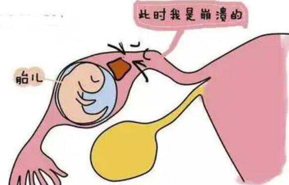 广州试管借卵生殖医院 2022广州市妇女儿童医疗中心做三代试管供卵费用全面分